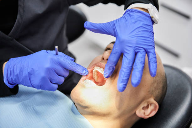 Best Emergency Treatment for Dental Infections or Abscesses in Lake Holiday, IL